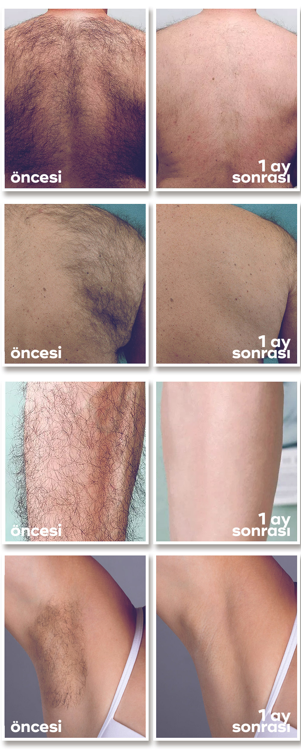 Epivia Tüy Dökücü Krem